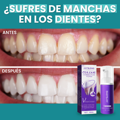 Tratamiento Dental Blanqueador