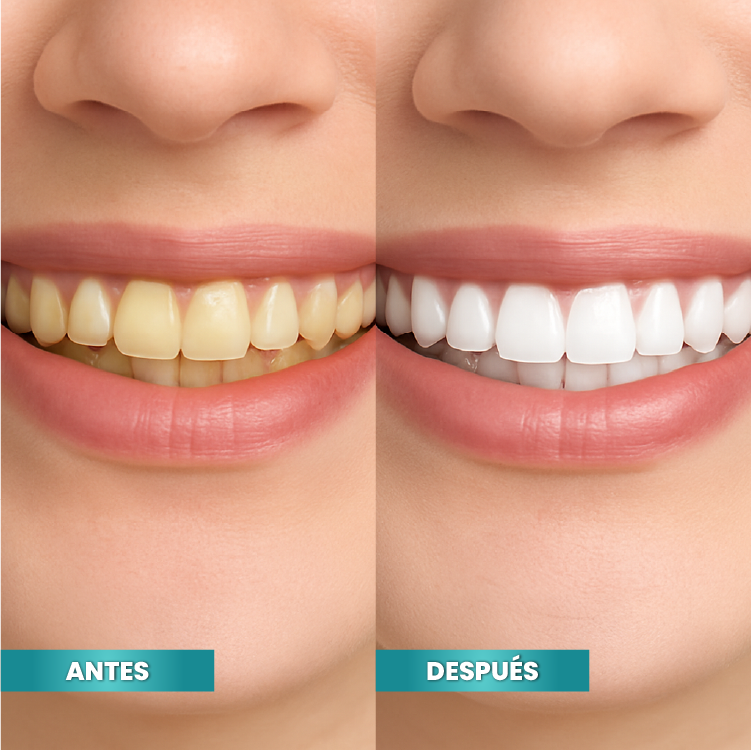 Marcador Sonrisa Perfecta