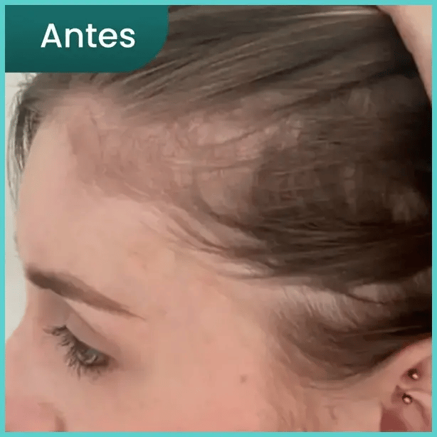 Serum Cuidado Capilar 50ML