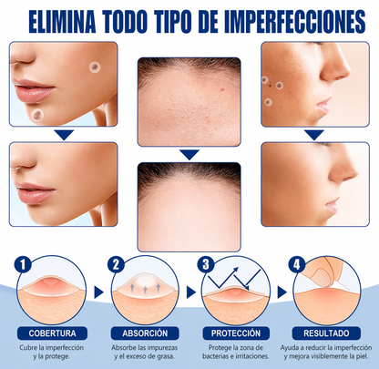 Parches para verrugas y lunares (108 unidades) – protección discreta