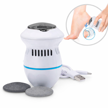 Removedor eléctrico de callos con succión – pies suaves en minutos sin esfuerzo