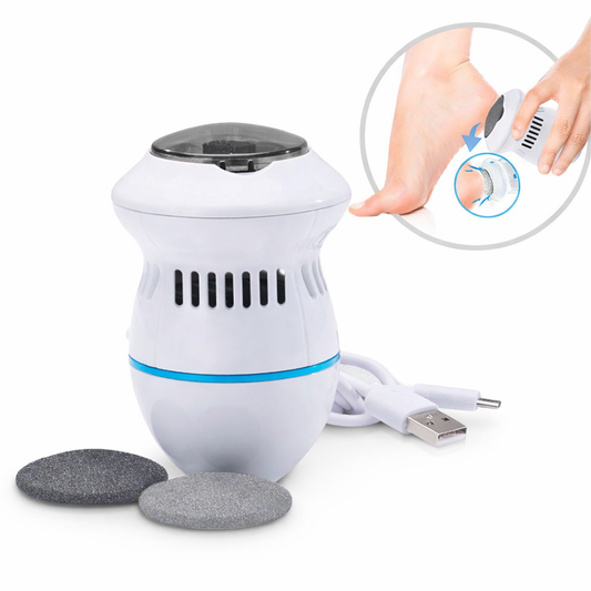 Removedor eléctrico de callos con succión – pies suaves en minutos sin esfuerzo