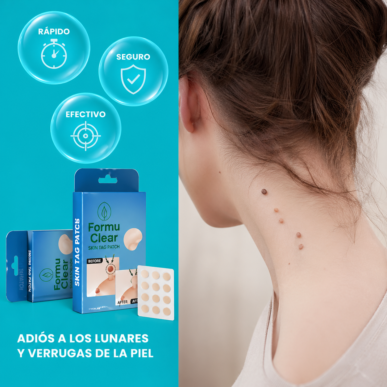 Parches para verrugas y lunares (108 unidades) – protección discreta