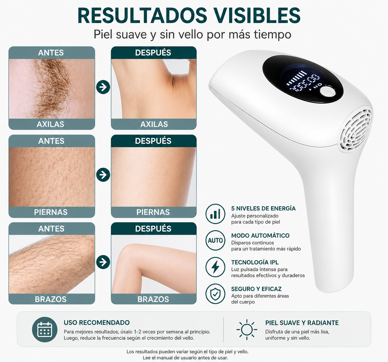 Depiladora Láser IPL para Reducción Progresiva del Vello