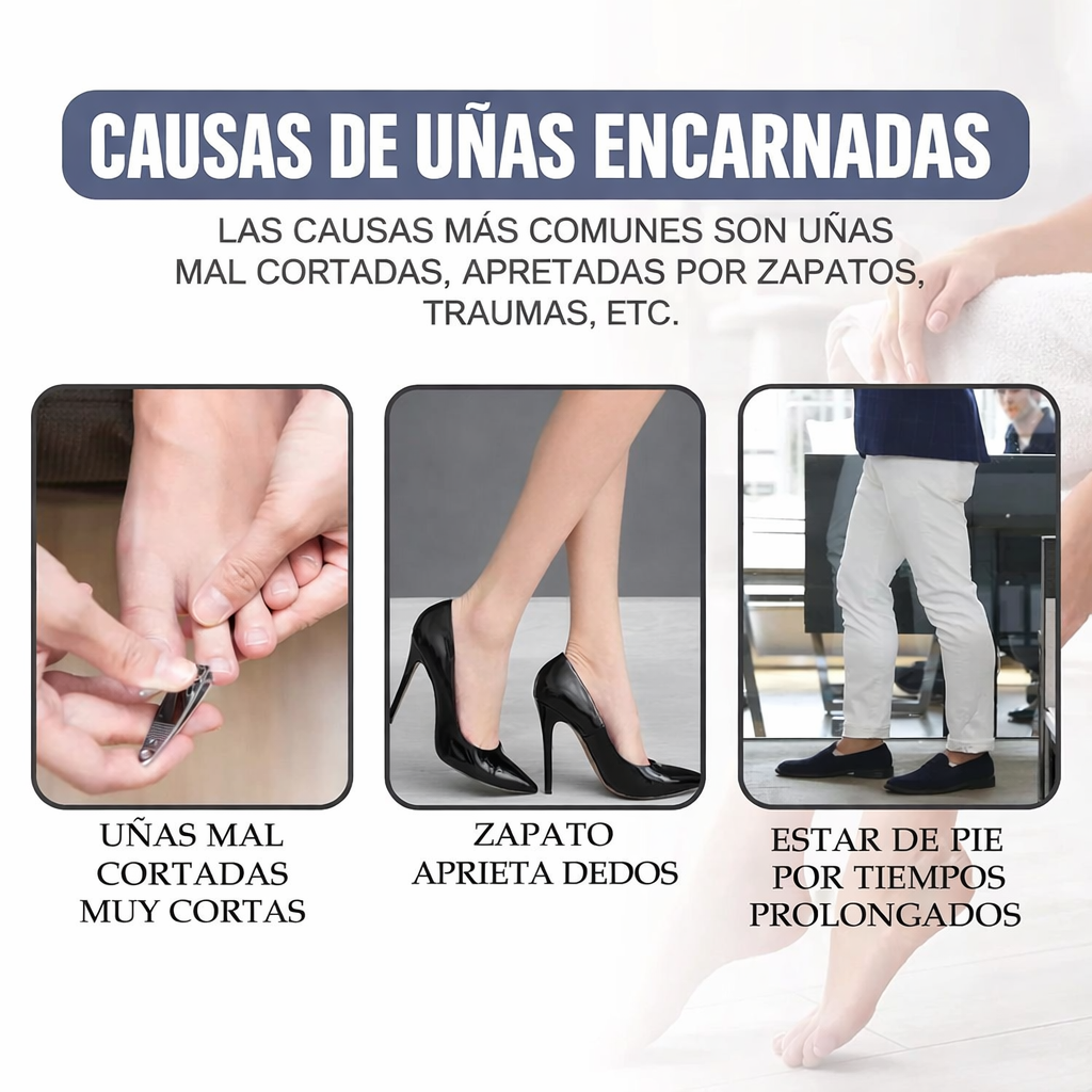 Tratamiento Para Hongos