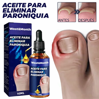Tratamiento Para Hongos