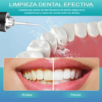 Irrigador Dental para Limpieza Profunda y Encías Saludables