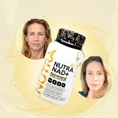 NAD RESVERATROL (Protege las neuronas)