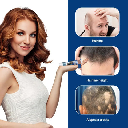 Crema Capilar Anticaída (Tratamiento para la Alopecia)