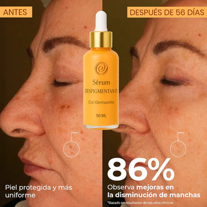 SERUM DESPIGMENTANTE