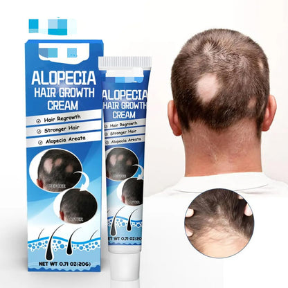 Crema Capilar Anticaída (Tratamiento para la Alopecia)