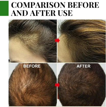 TRATAMIENTO PARA CRECIMIENTO CAPILAR